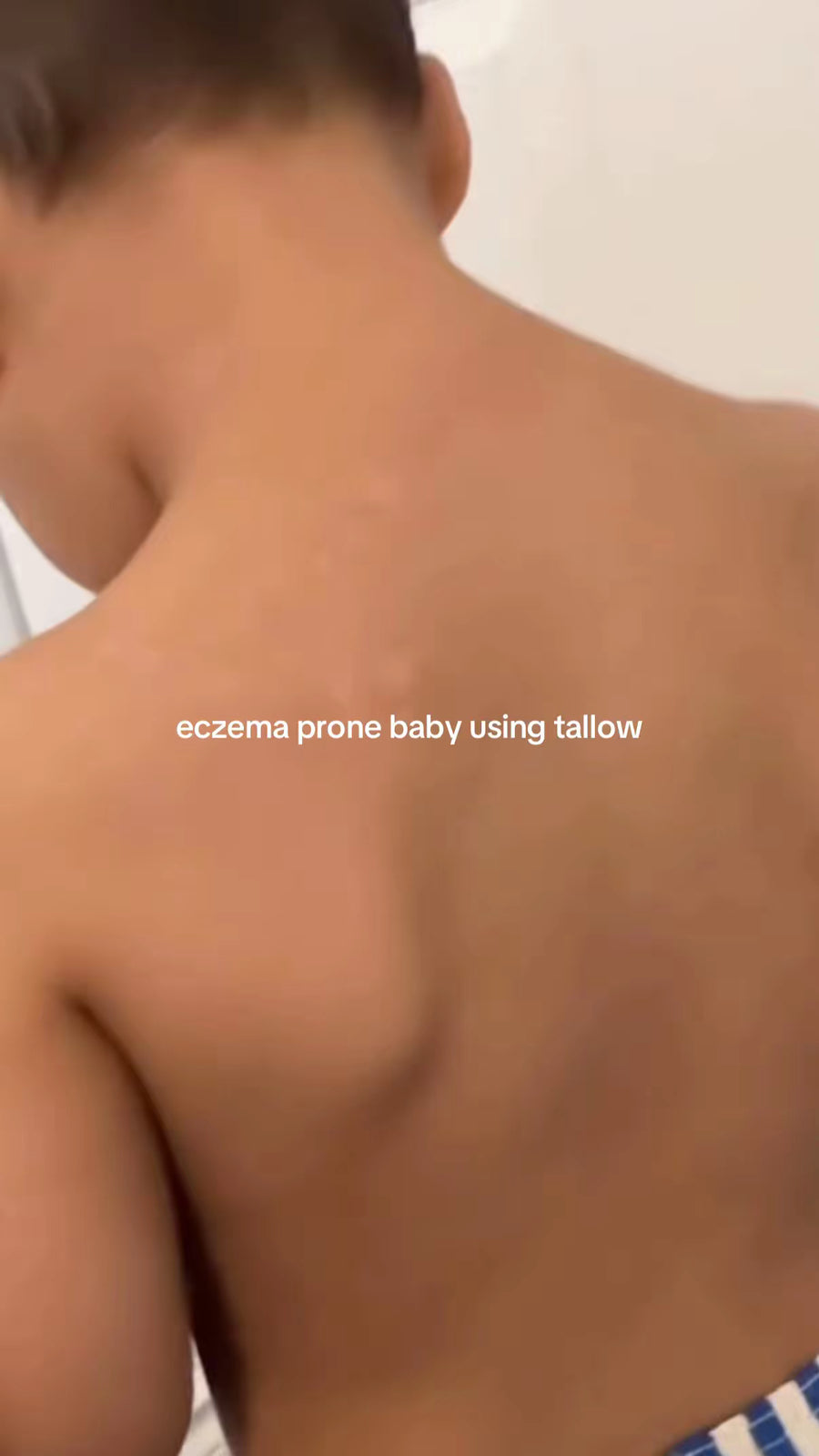 Same baby's back after using tallow, skin calm