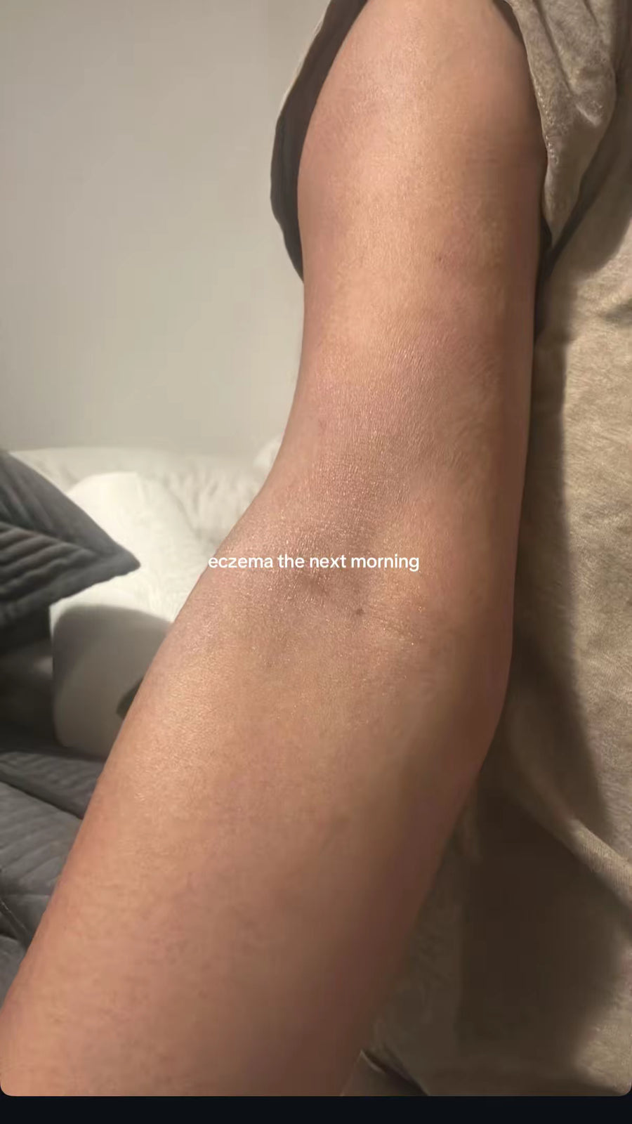 Same forearm the next morning after tallow