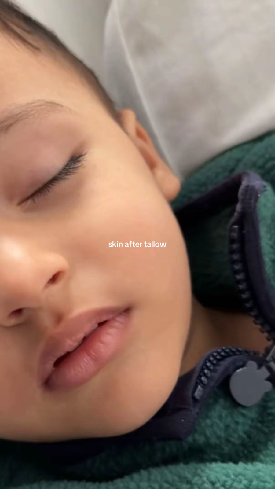 Baby's cheek after tallow, calm and smooth